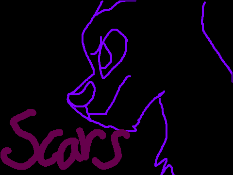 Scars