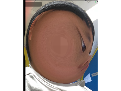 Thick remix