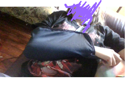 I broke my collarbone guys