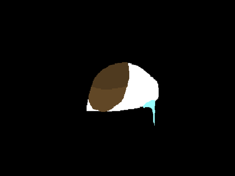 Migraine AMV WIP