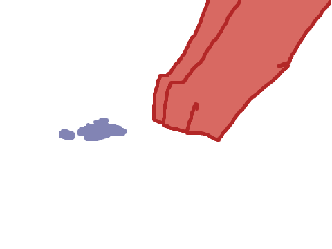 Stitches Part 16 (WIP)