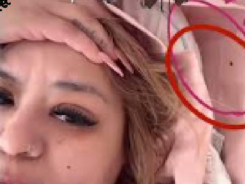ash trevino bed bug