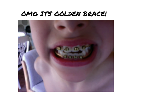 U WANNA SEE MY GOLD?!
