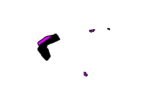 lazer test