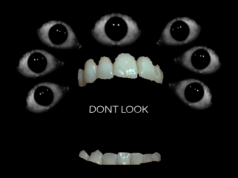 ignore pls