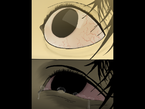 eye