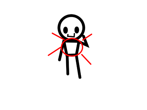 accidental body type???