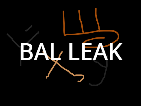Shwe gets hurt but Ha with hook fixes him (BAL Leak)