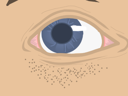 an eye project