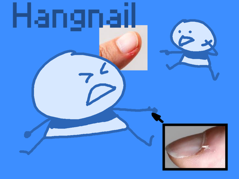 Hangnail #hangnail