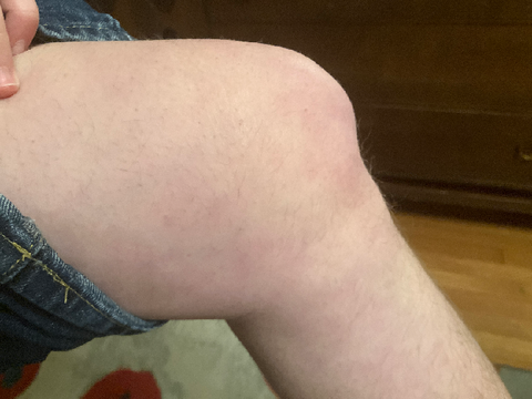 Knee