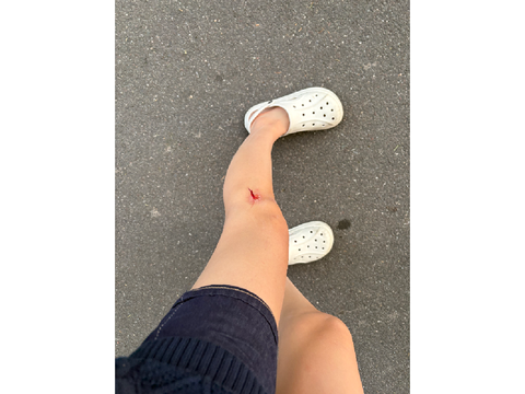 Me casually bleeding out 