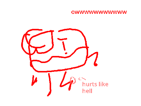 I fractured my ankle probably /srs