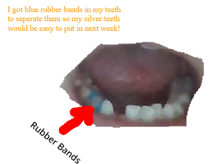 I went to the dentist today!