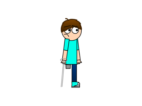 Because of jacob biting AHAS4S leg, his left leg is amputated.