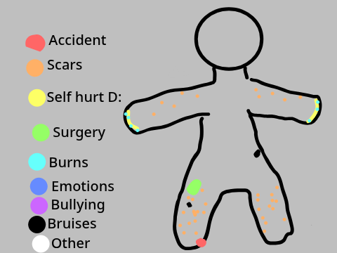 Elliot's injuries