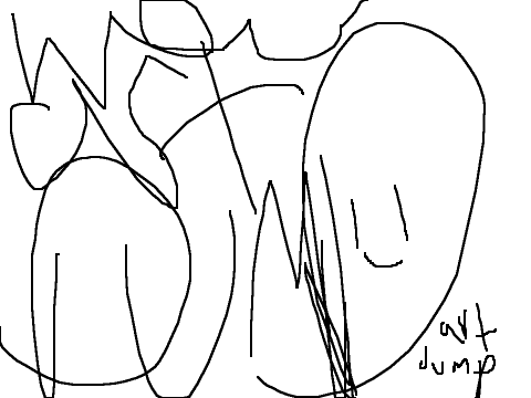 aRT DuMP 2)17