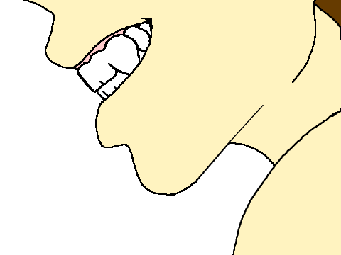 Doubt MAP [part 3]