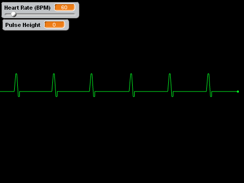 Pulse