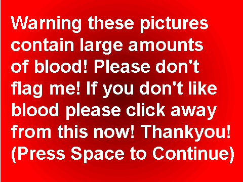 My art*BLOOD WARNING!*