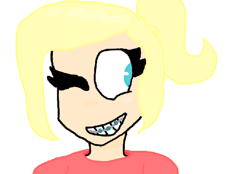 I got the braces!!