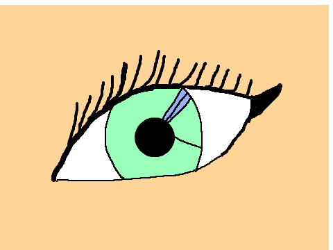Eye Contest! remix