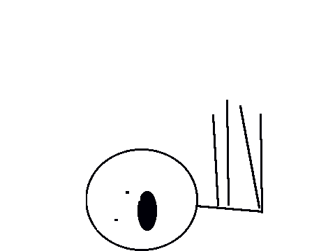 animation awesxome squid v.s man awesome