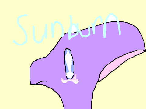 sunburnt meme remix-2