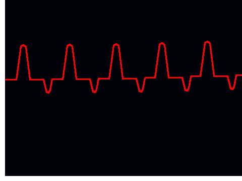 Heartbeat