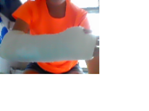 Fractured my arm :(