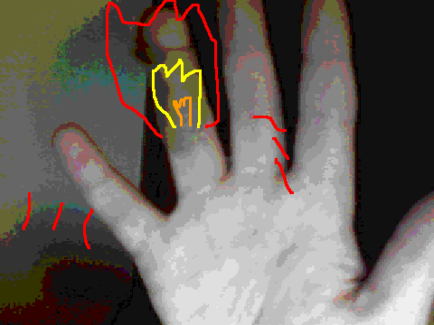 MAI FINGAH HAZ BURSTID INTO FLAMEZ