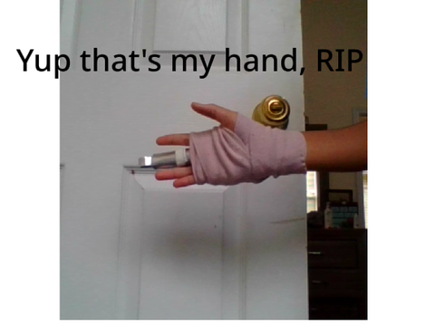 My hand, oof