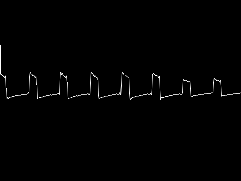 OSCILLOSCOPE