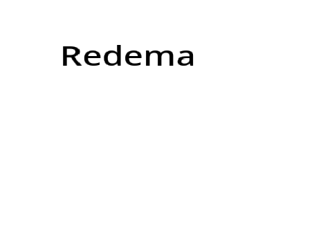 Redema - a scary story ish