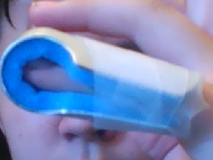 My disslocated finger finger T^T