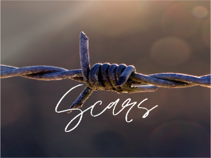 “Scars” ~Contest Entry~