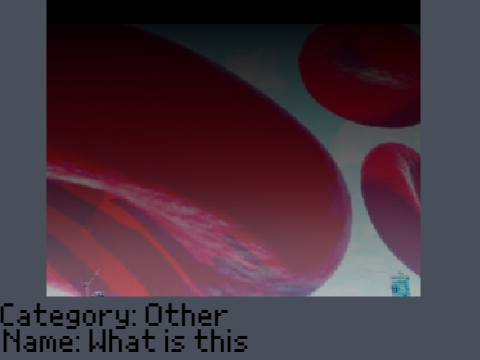 What are those called