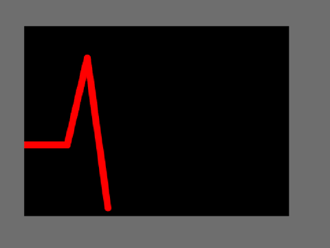 Heart rate