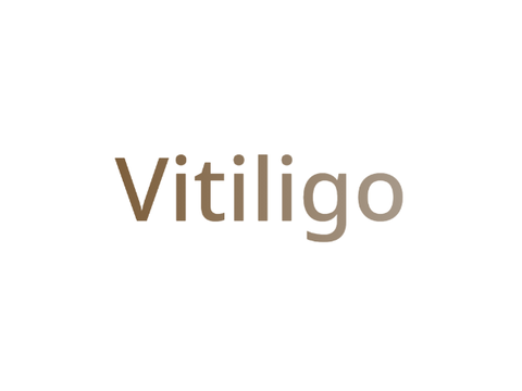 Vitiligo