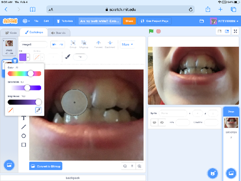 Are my teeth white? -ODD-