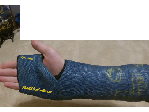 Sign my cast.