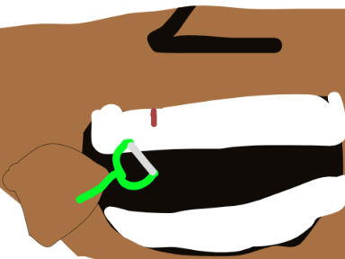 Flossing E&R 