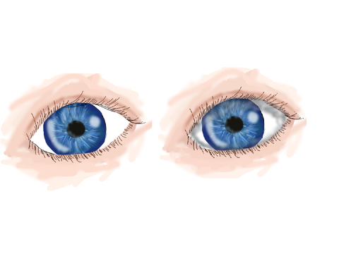 Random eye drawing