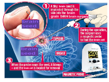 brain seed grow in your *BRAIN no not a lieeee just click