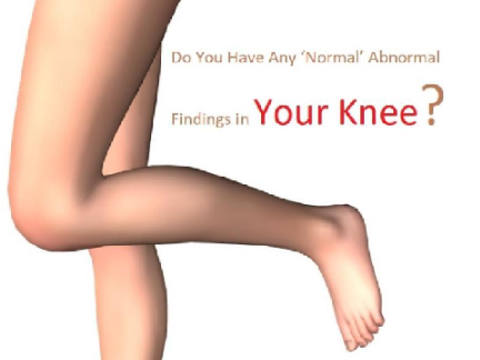want a knee? weird knee?