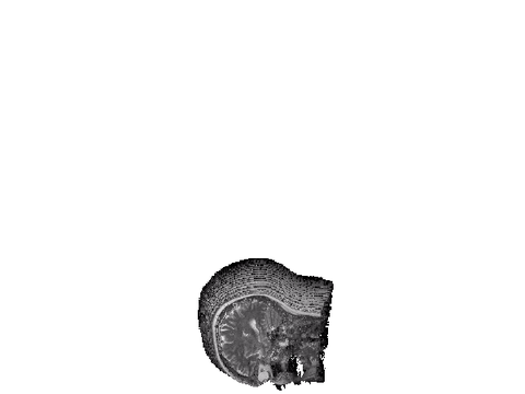 3D brain scan