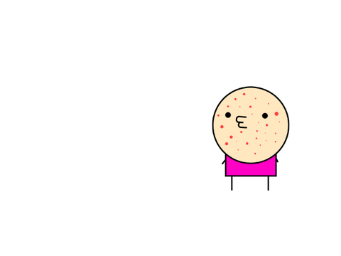 Measles remix
