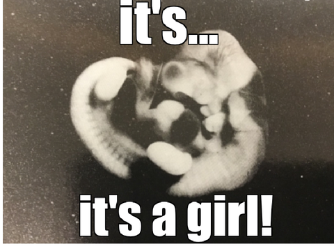 It’s….it’s a girl!