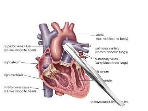 FailedProjectCode:890HeartSurgery