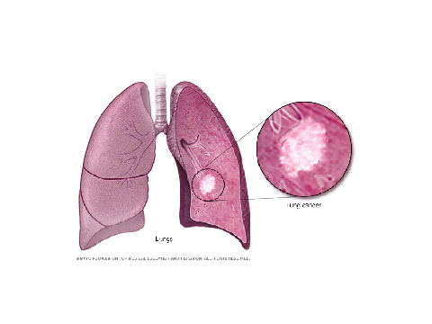 cough reveal